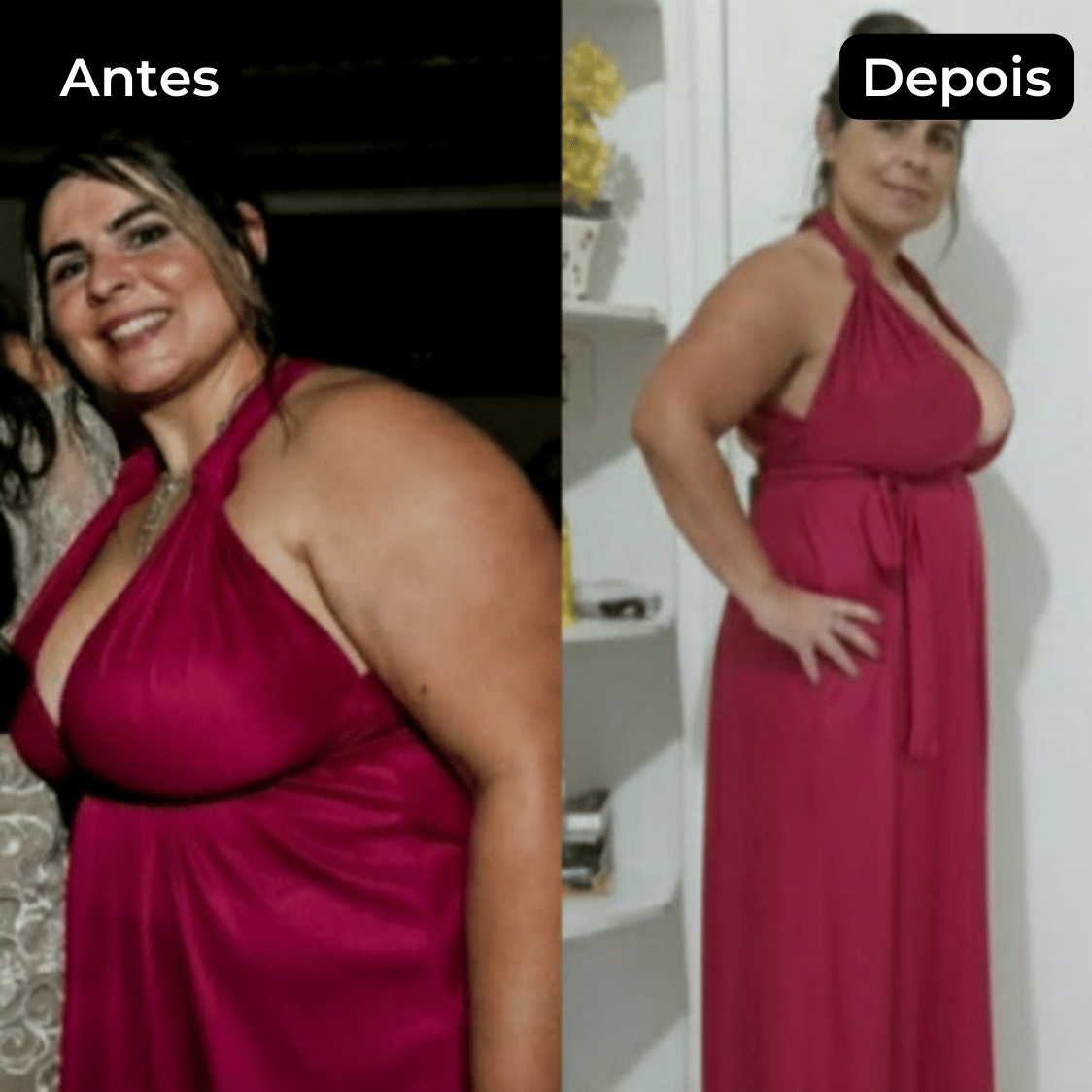 antes e depois 5